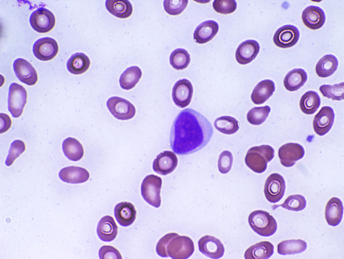 Peripheral blood 1000x